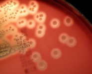 enterococcus faecalis on blood agar